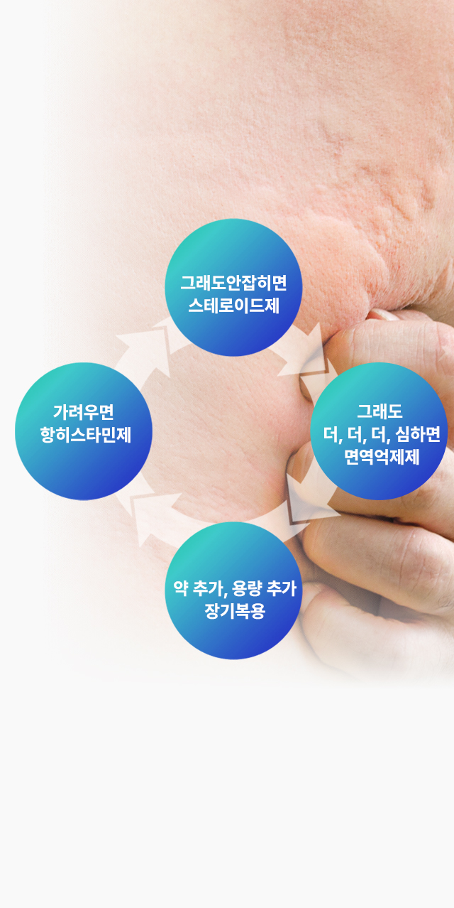 원인별 두드러기 치료