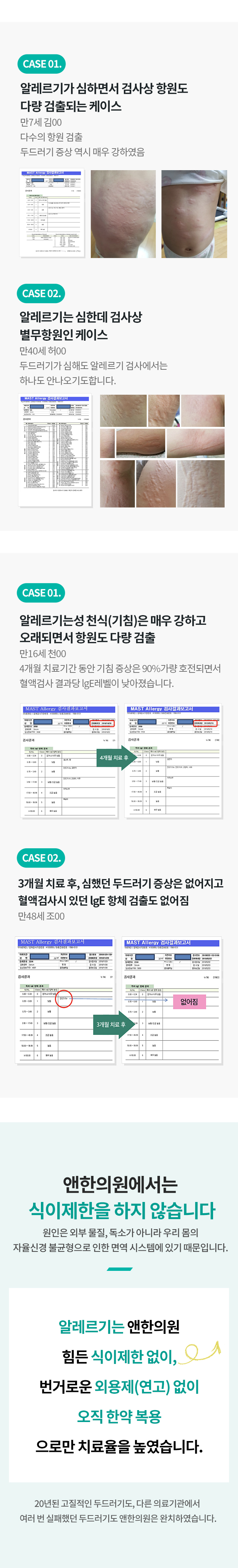 원인별 두드러기 치료