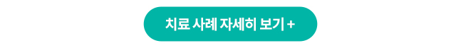 편두통